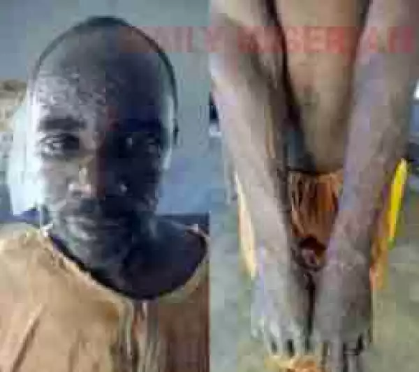  Kano Records First Monkey Pox Case, Patient Flees From Hospital (Photos)